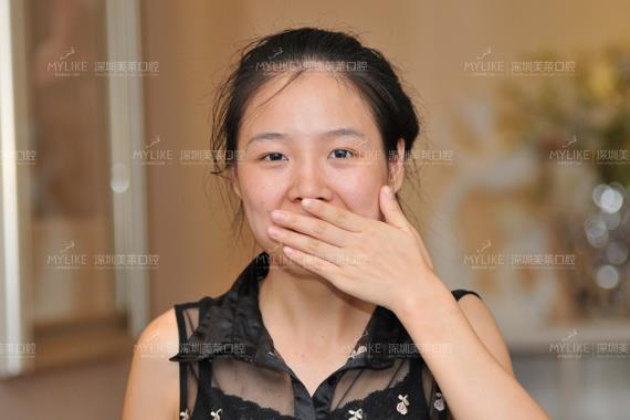 冰晶矫正案例
