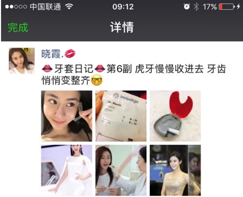 0元矫牙梦想秀